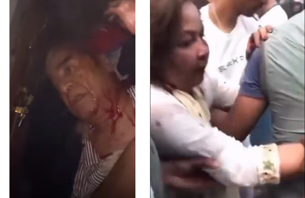 आगजनी भएकै घरमा भेटिए देउवा सम्पत्ति, शेरबहादुर घाइते